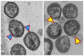 Electron microscopy of HIV. Left: Mature, fully formed HIV particles (blue arrows). Right: Immature, misshapen HIV particles (yellow arrows) that formed following treatment with thenSMase2-blocking compound that stopped growth of the virus. Credit: Abdul Waheed, Ph.D., Center for Cancer Research, National Cancer Institute, National Institutes of Health.