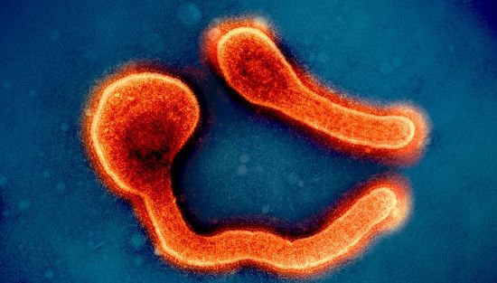 Colourised transmission electron micrograph of two Marburg virus particles (orange). Tanzania has declared an outbreak of the virus. Copyright:NIAID(CC BY 2.0).