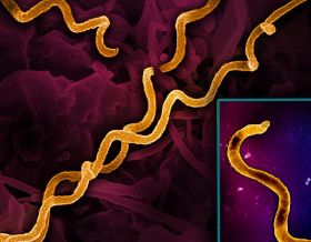 Electron micrograph imagery of Treponema pallidum, the bacteria that cause syphilis, including a foreground close-up of a single particle (right). Spiral-shaped bacteria are colorized in gold. NIAID