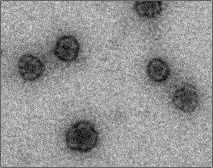 Image: Transmission electron microscopy image of the antifungal nanodiscs. Image: Transmission electron microscopy image of the antifungal nanodiscs.