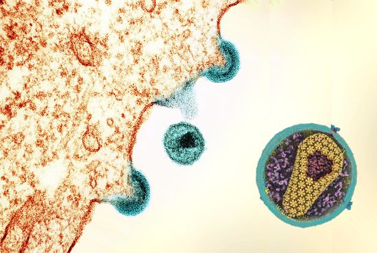 Transmission electron micrograph of HIV-1 virus particles (teal) exiting an infected immune cell after replicating inside the cell. Inset: Interior view a HIV-1 virus showing the capsid (yellow) that surrounds the RNA and enzymes necessary for replication. Credit: National Institute of Allergy and Infectious Diseases