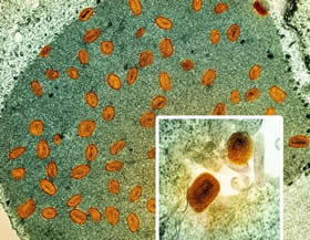 Image: Colorized transmission electron micrographs of mpox virus particles (orange) found within infected VERO E6 cells (green), including a foreground closeup. Captured at the NIAID Integrated Research Facility in Fort Detrick, Maryland.

Credit: NIAID