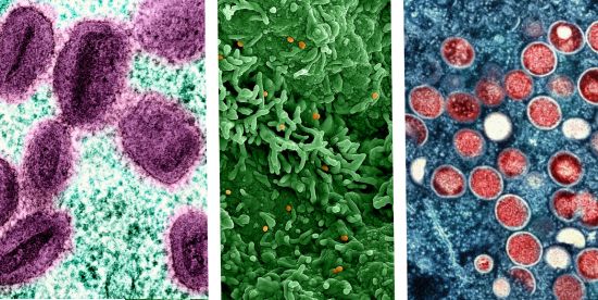 Photo: Different forms of the mpox virus particles shown under the microscope. (NIAID)