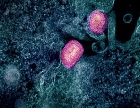 Colorized transmission electron micrograph of two mature mpox virus particles (pink) attached to the surface of an infected VERO E6 cell (blue/teal). Image captured at the NIAID Integrated Research Facility in Fort Detrick, Maryland. Credit:NIAID