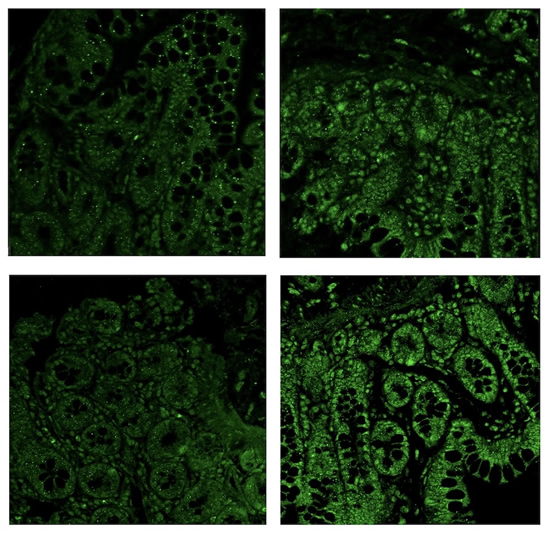 placebo v thc serotonin receptors in the gut